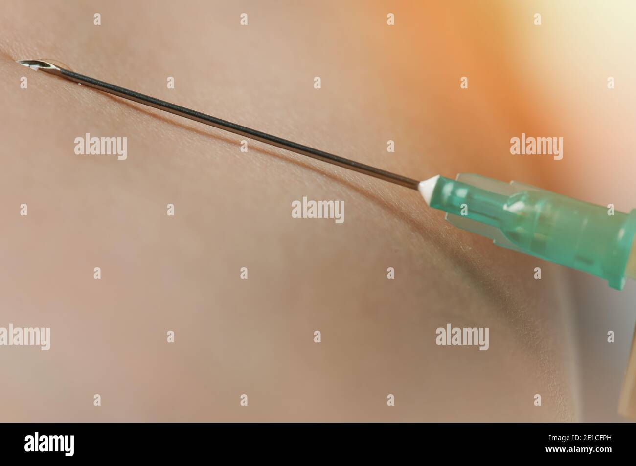 Metal end of injection needle macro view on human skin background Stock ...