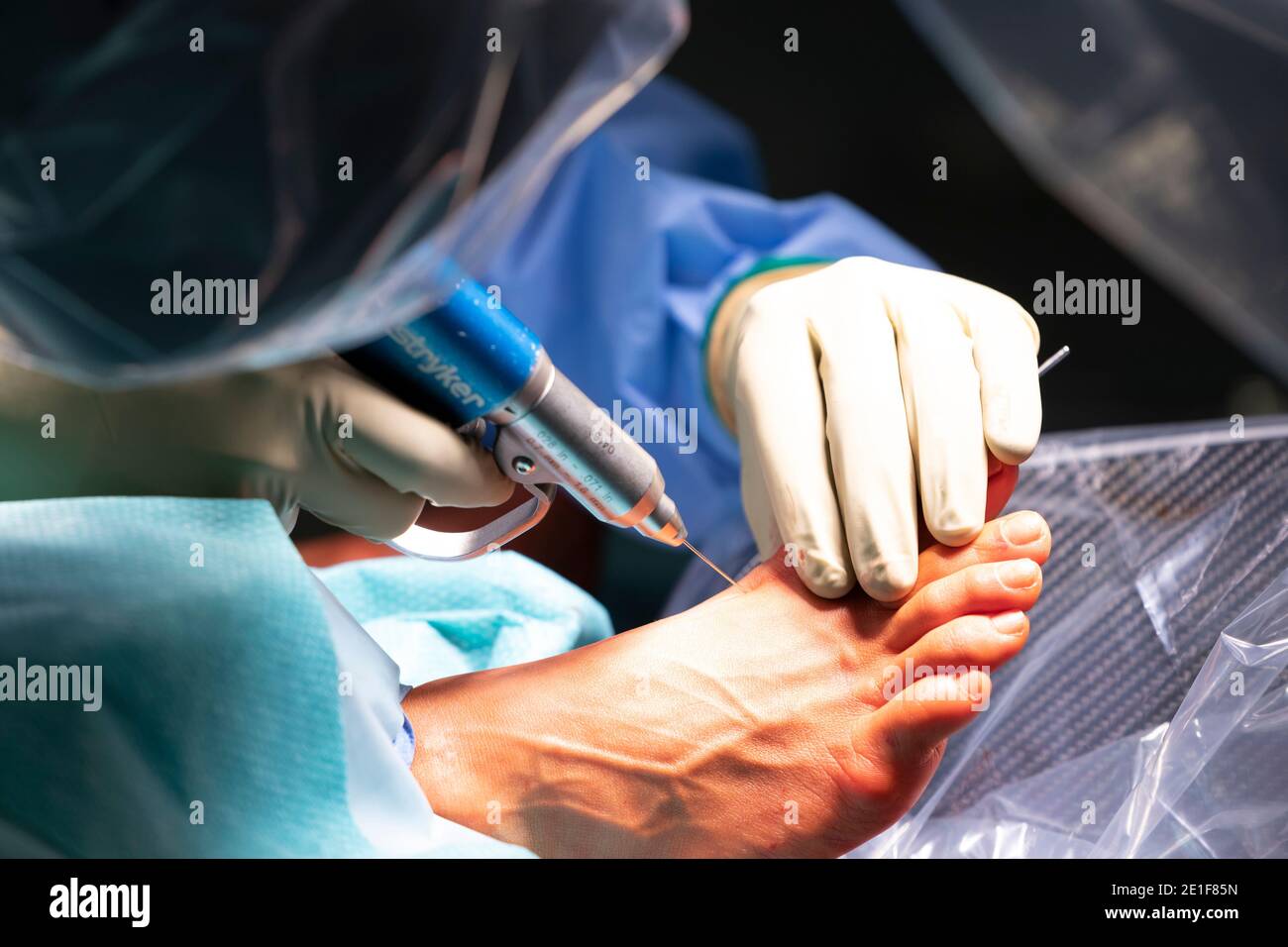 a surgeon operates on a foot with minimally invasive instruments Stock Photo