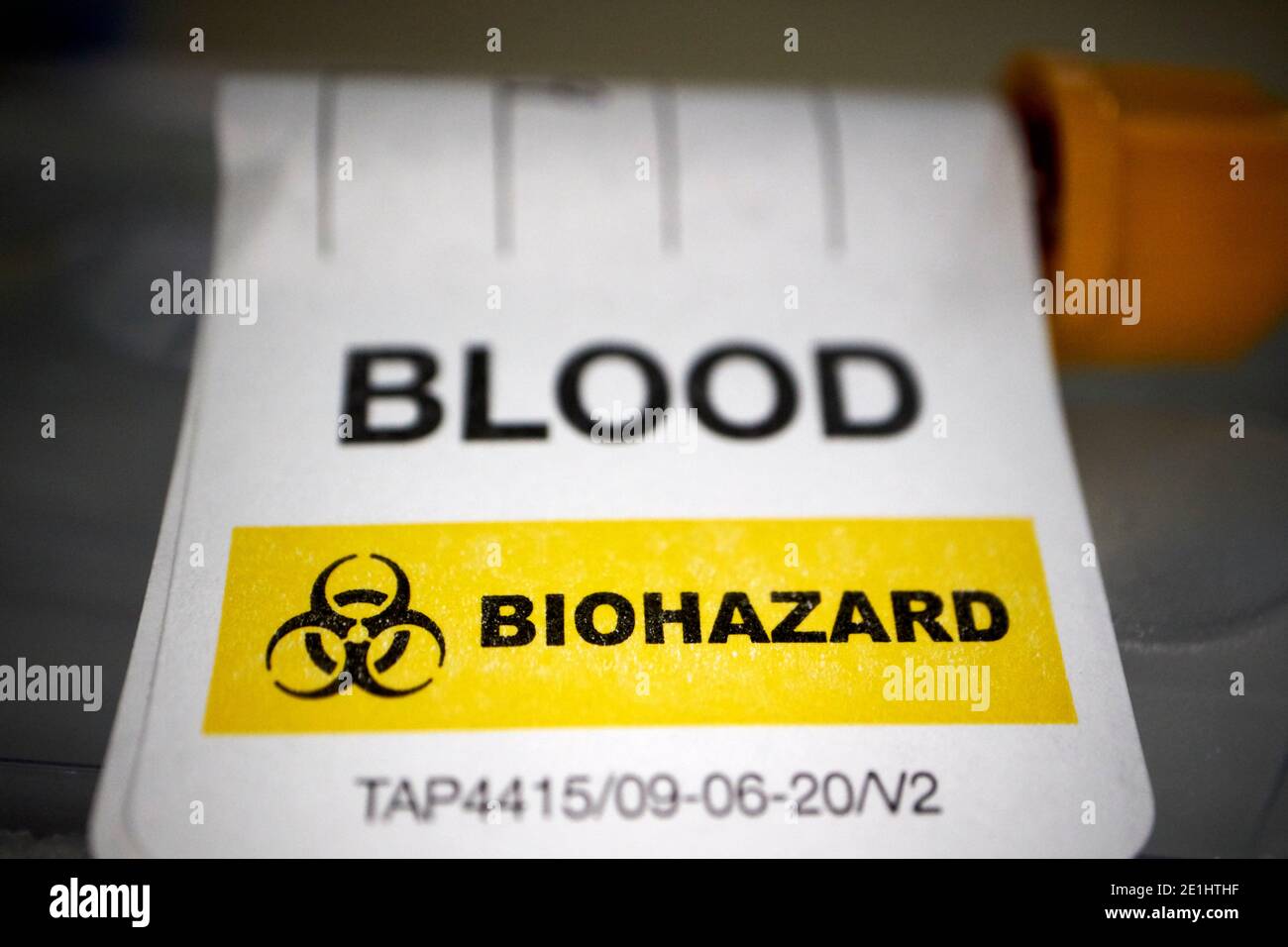 blood sample labelled blood and biohazard for commercial covid-19 antibody blood test kit for home testing for coronavirus antibodies received in the uk Stock Photo