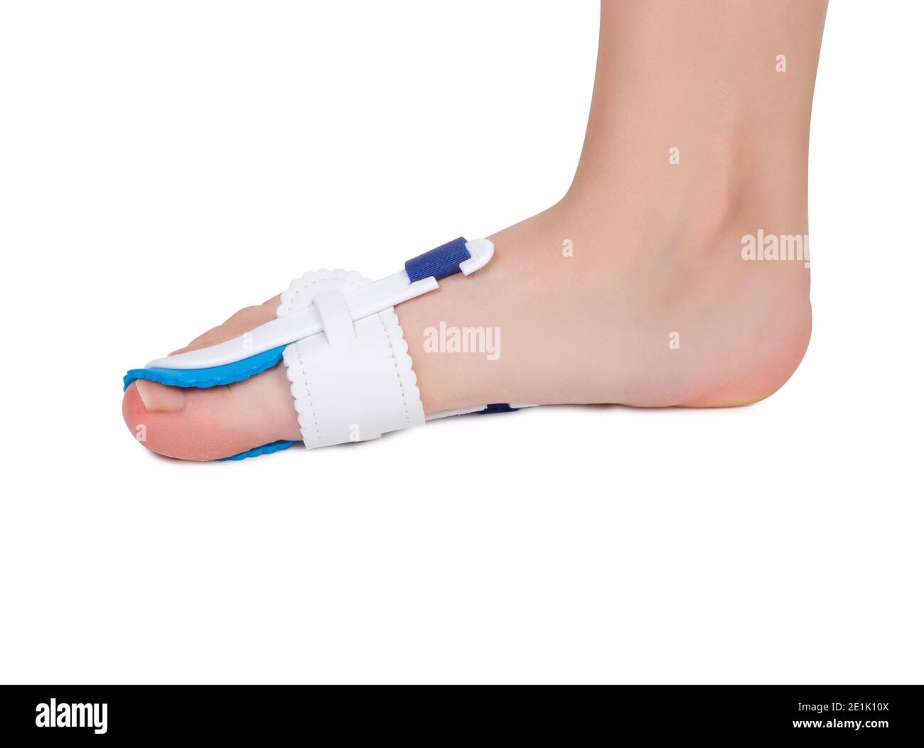 Special medical orthopedic bandage to nonsurgical treatment of a thumb deformity also known as Hallux Valgus. Stock Photo