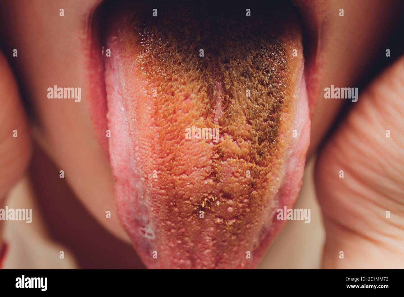 dirty tongue, close-up, dark brown after soda Stock Photo
