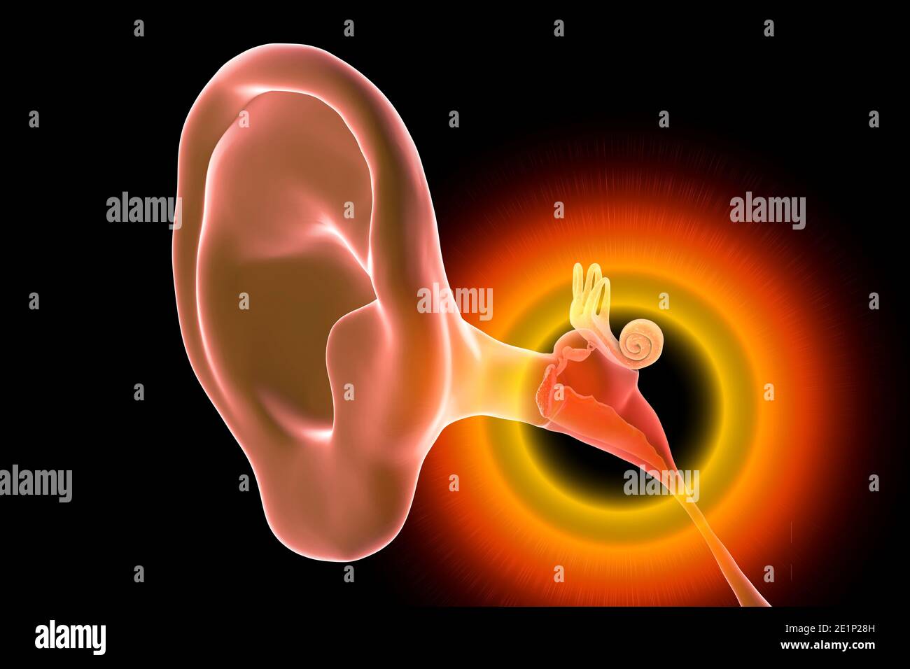 Otitis media ear infection, illustration Stock Photo Alamy