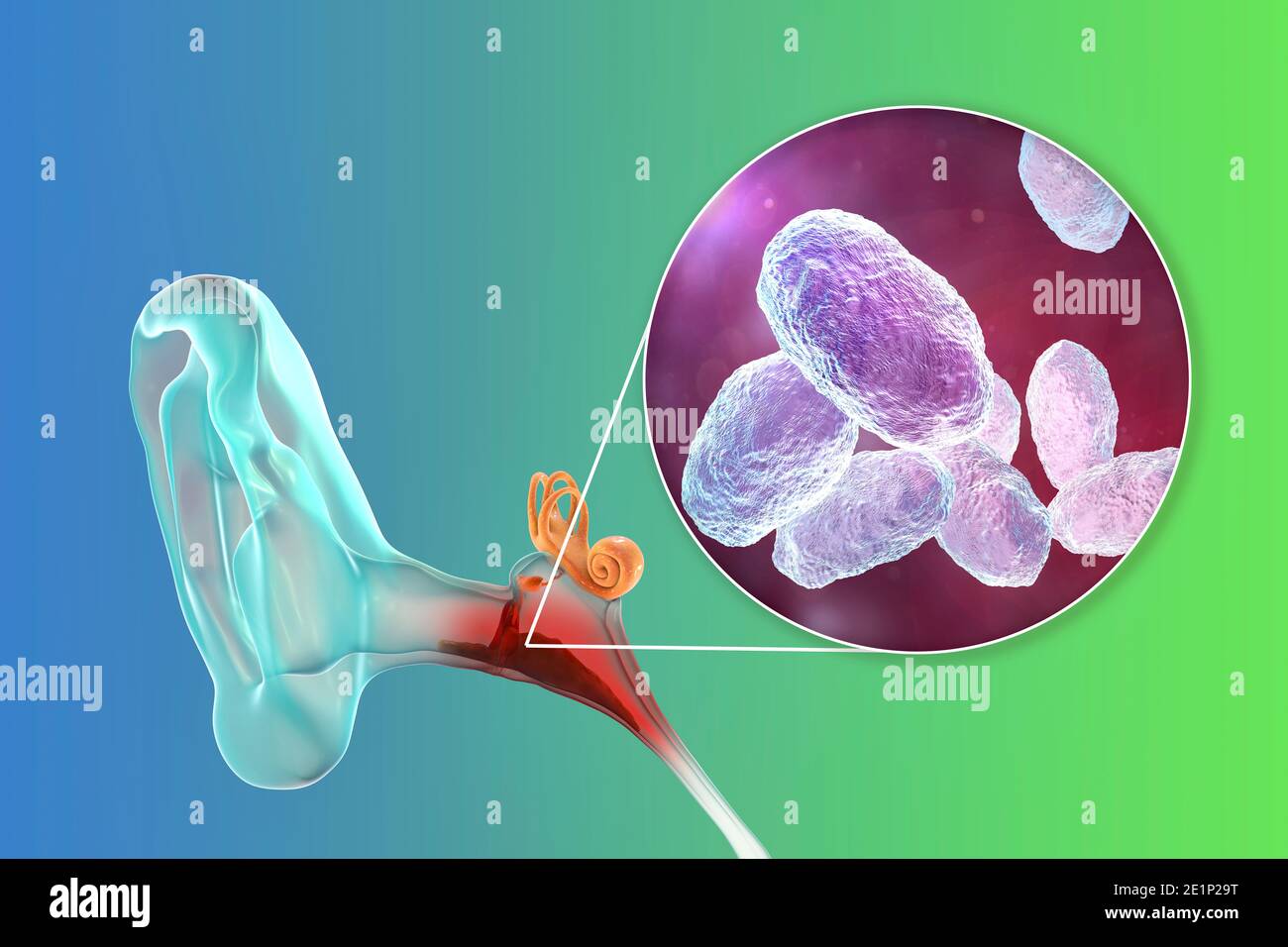 Otitis media ear infection, illustration Stock Photo Alamy