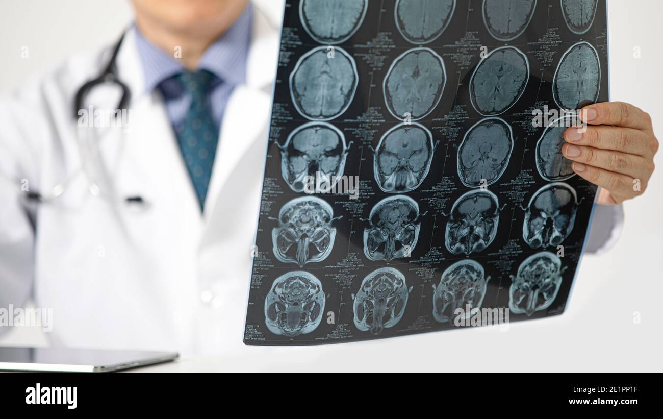 A doctor sitting on a desk looking at MRI scan of the brain of a patient. Selective focusing, blurred background. Stock Photo