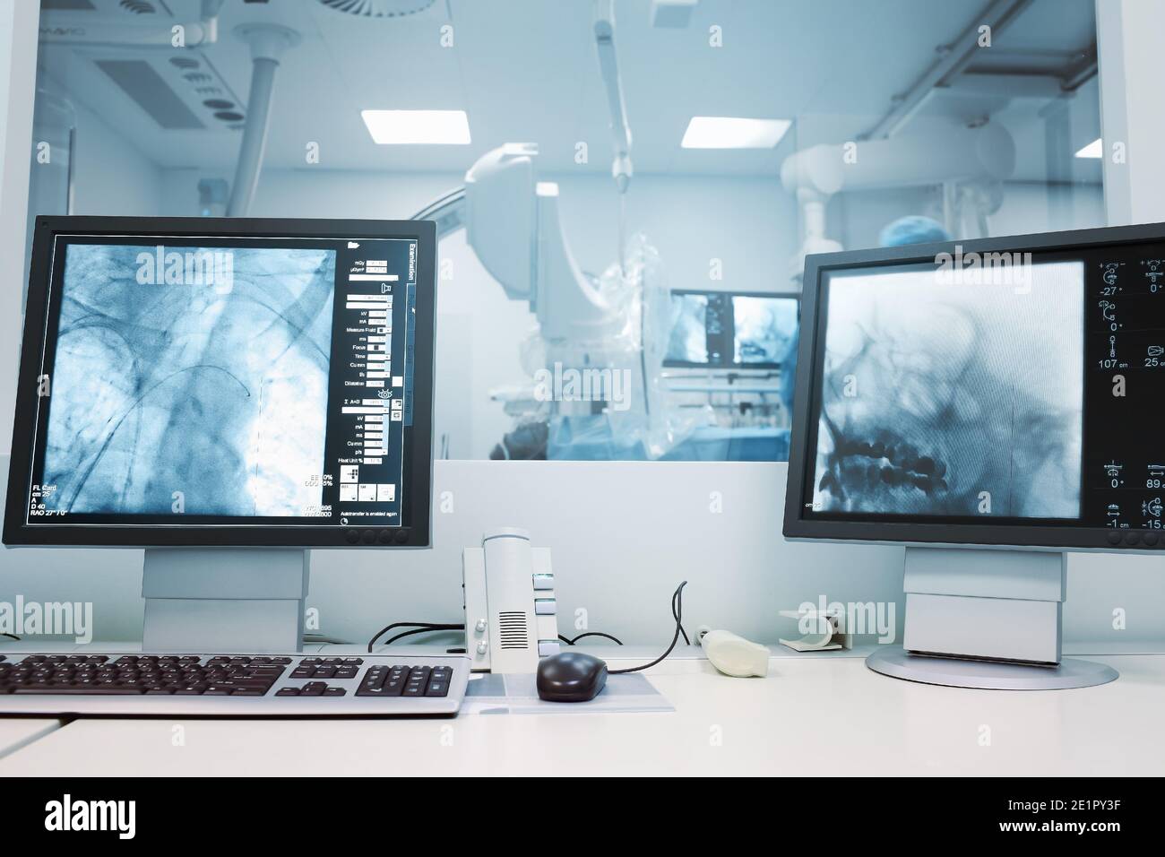 Computer monitoring of brain operation Stock Photo - Alamy