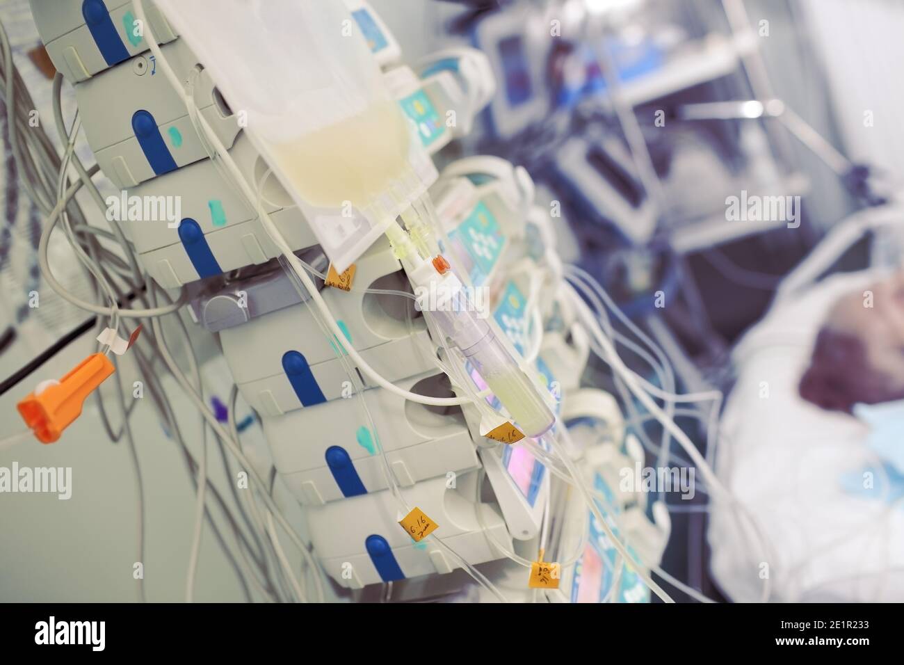 Transfusion of blood components to a patient in critical condition. Stock Photo