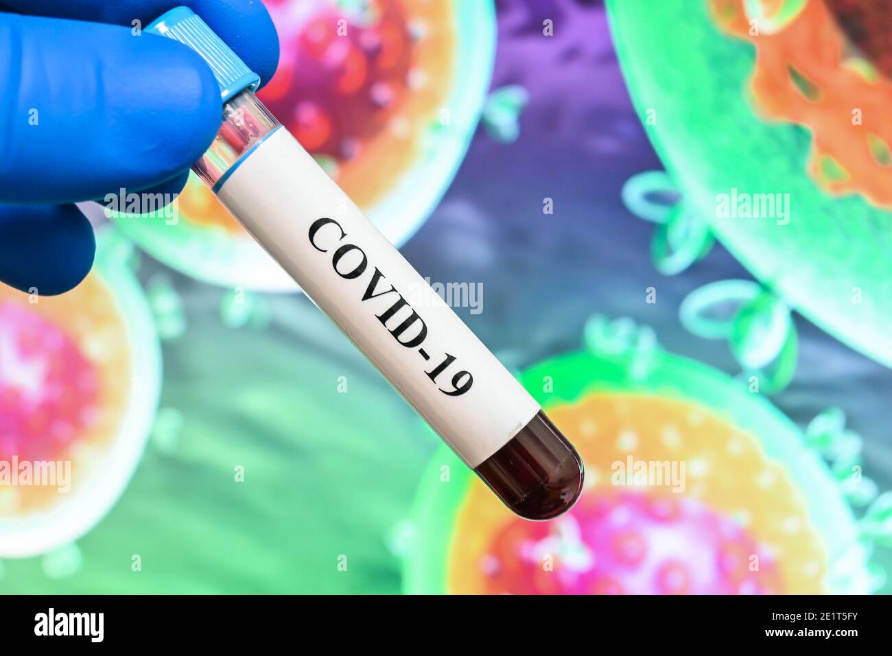 Coronavirus test. Detection of antibodies for COVID19 in a blood