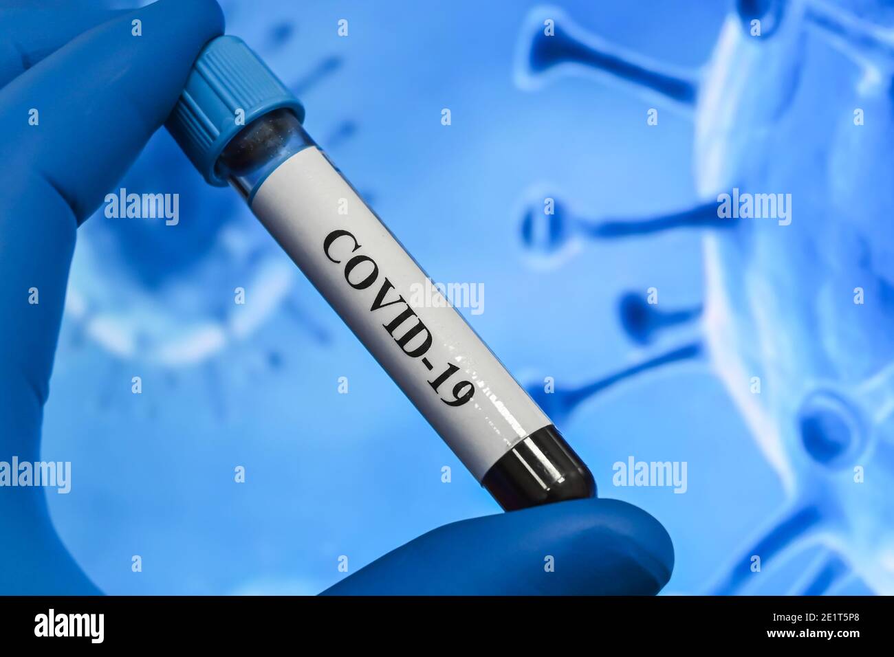Coronavirus test. Detection of antibodies for COVID-19 in a blood sample. Stock Photo