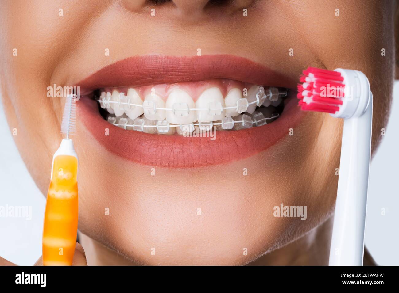 Female Cleaning Dental Brackets In Mouth Using Toothbrush Stock Photo