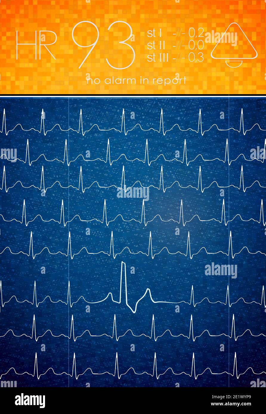 ECG background with an blank space. Stock Photo