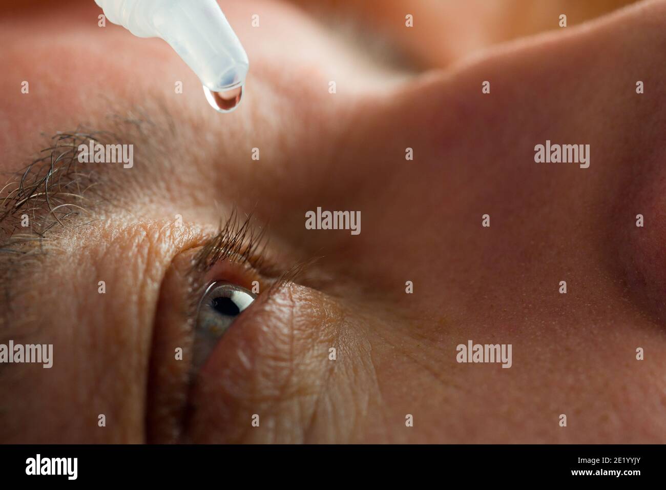 A man puts eye drops in his eyes before putting on contact lenses. Solution vision problems. Stock Photo