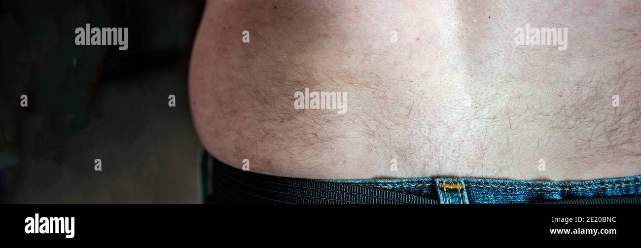 Back hair caused by increased age on a white male Stock Photo - Alamy