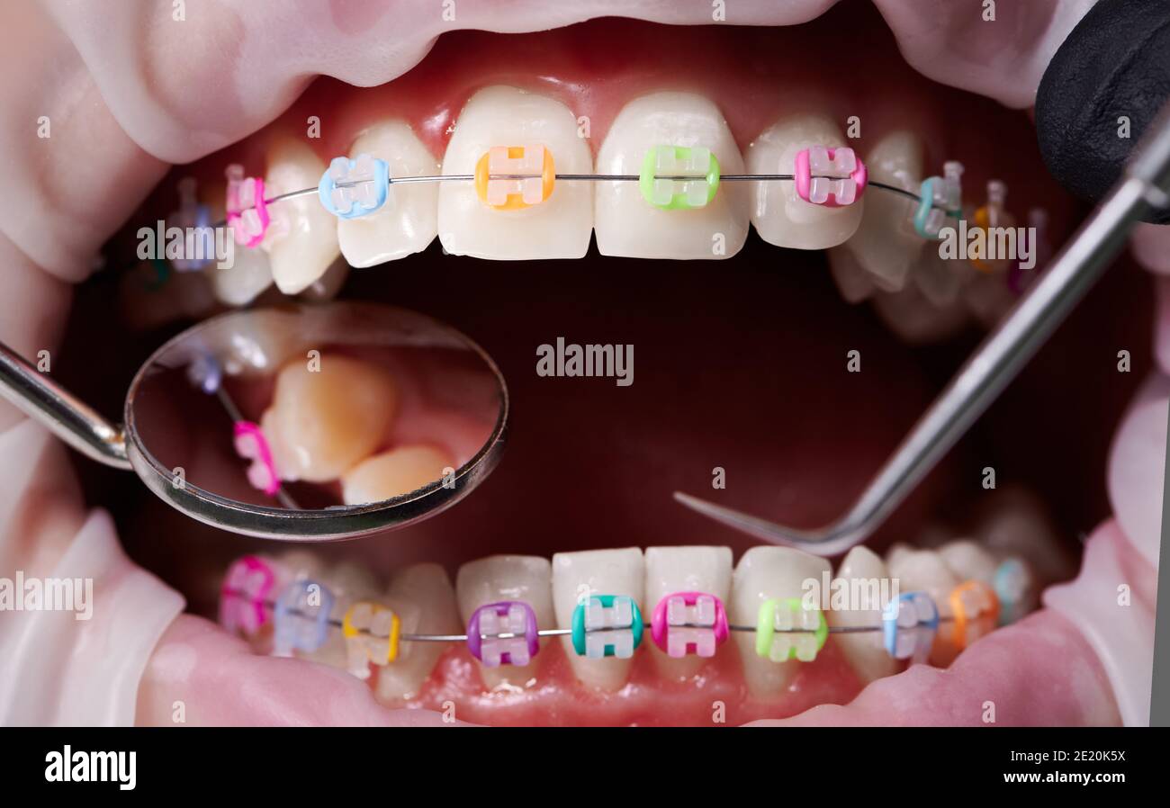 Rubber band mouth instrument deals