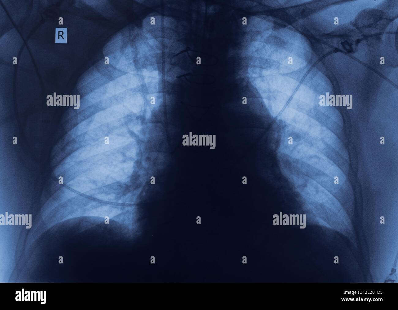 X-ray image with space for your ideas. Stock Photo
