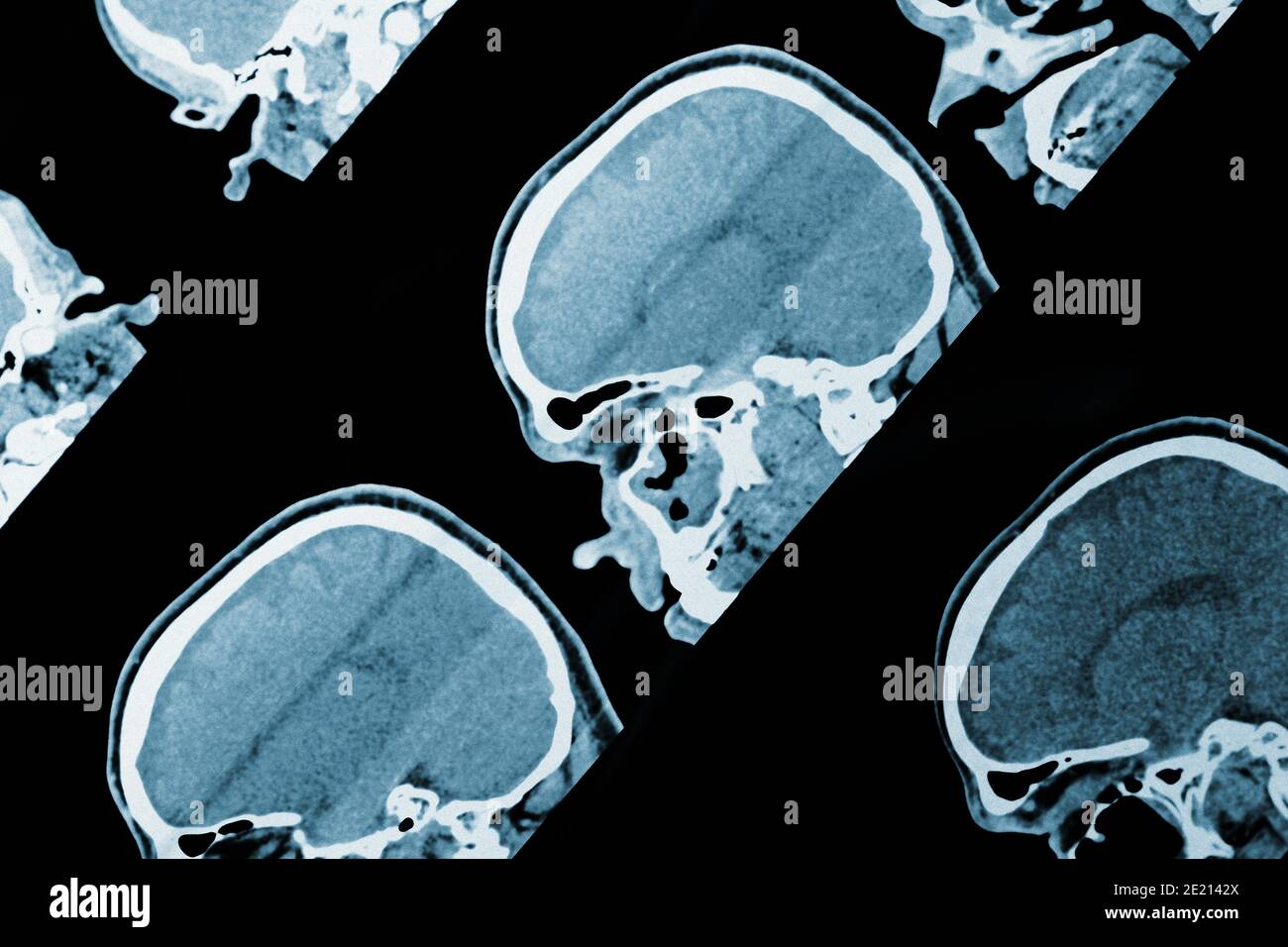 MRI scan image of head as medical background. Stock Photo
