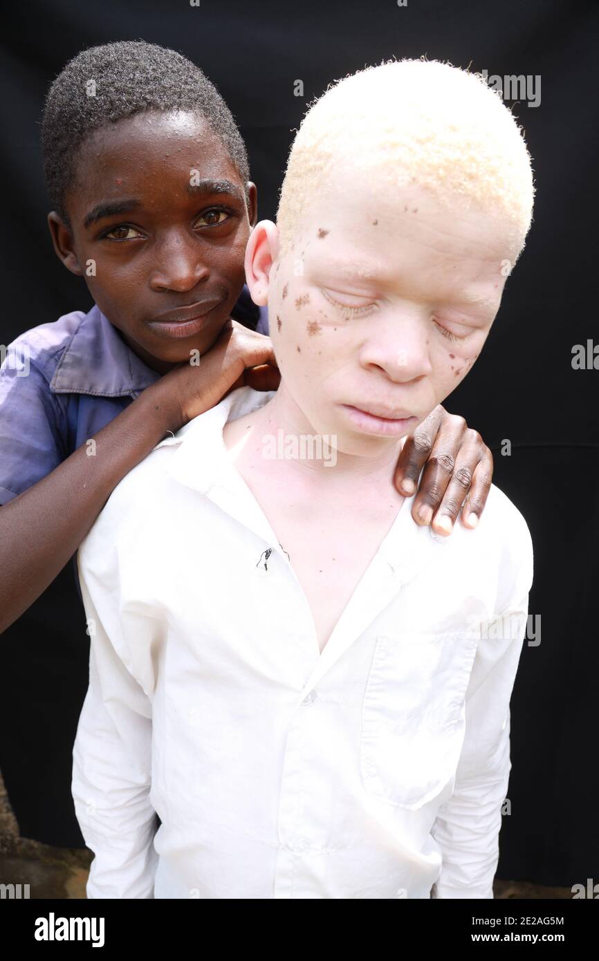 Albino diversity hi-res stock photography and images - Alamy