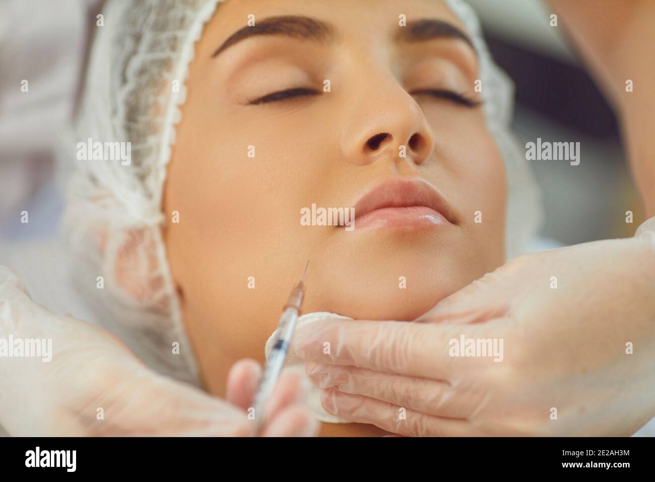 therapists hands in gloves with syringe and cotton pad making filler injection in womans underlip Stock Photo