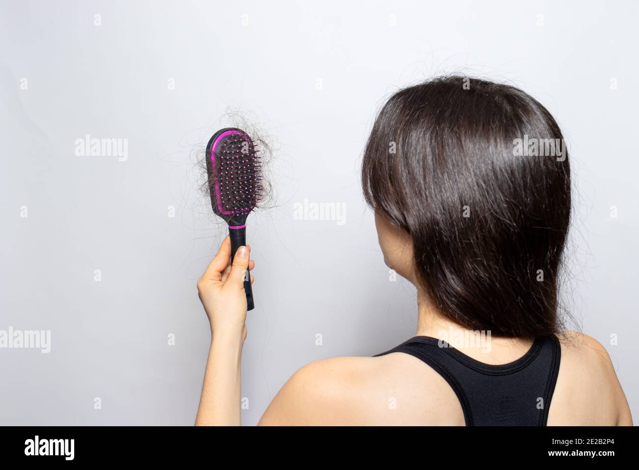 The girl holds a comb for hair with fallen hair. Hair loss, hair care Stock Photo