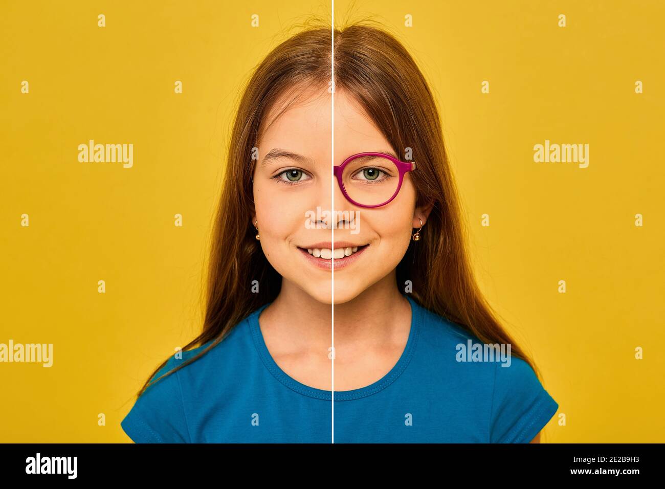 Caucasian girl face, cut in half to present before and after checking vision. Child face without glasses and with glasses on yellow background Stock Photo