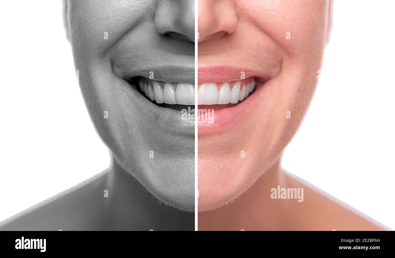 Skin difference hires stock photography and images Alamy