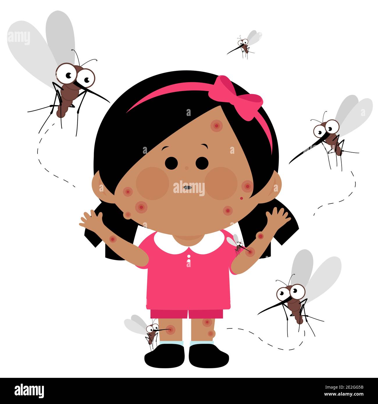 Illustration of a girl with red itchy skin with mosquito bites. Mosquitoes  flying around her and biting her Stock Photo - Alamy