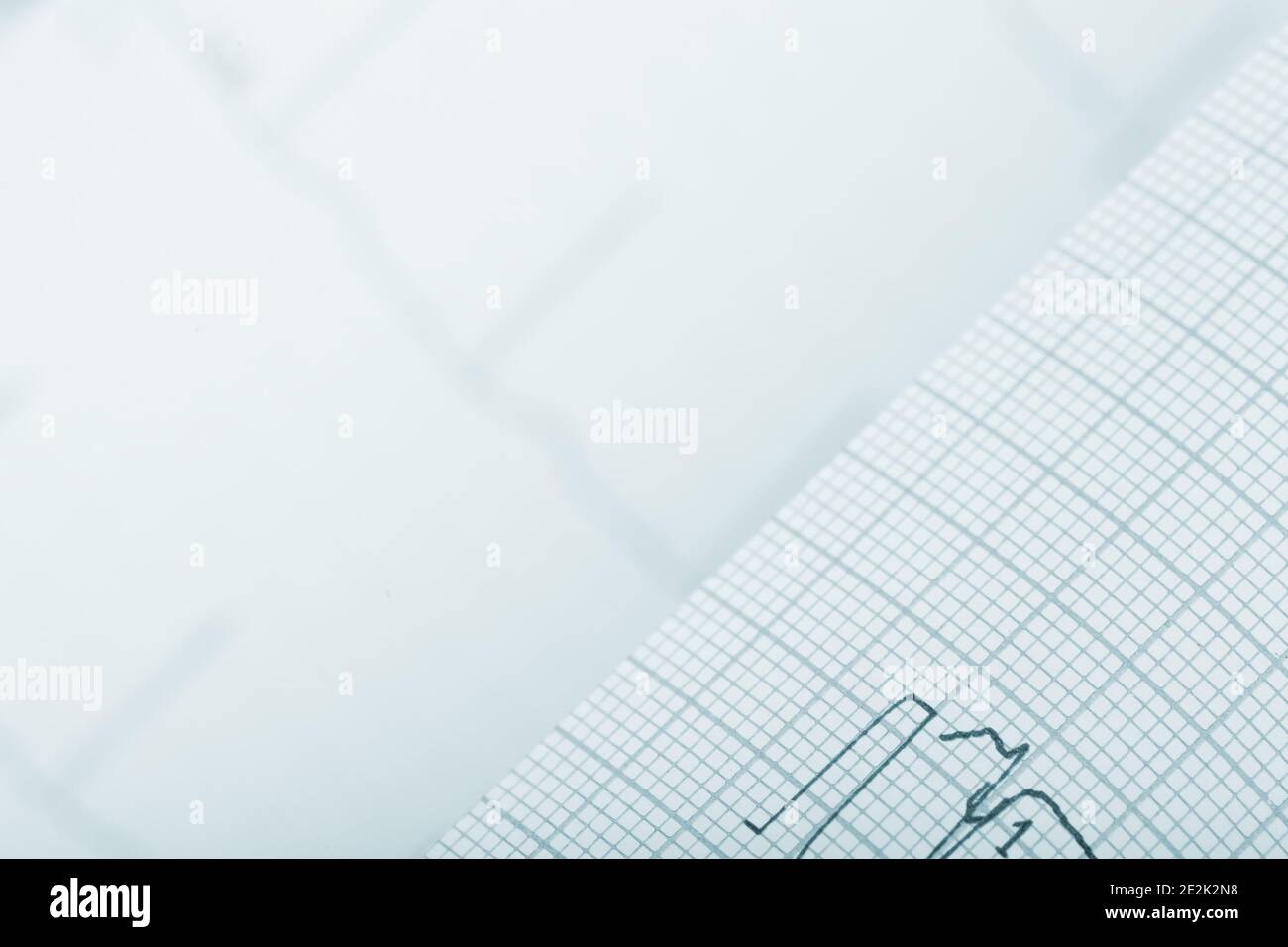 Ecg study hi-res stock photography and images - Alamy