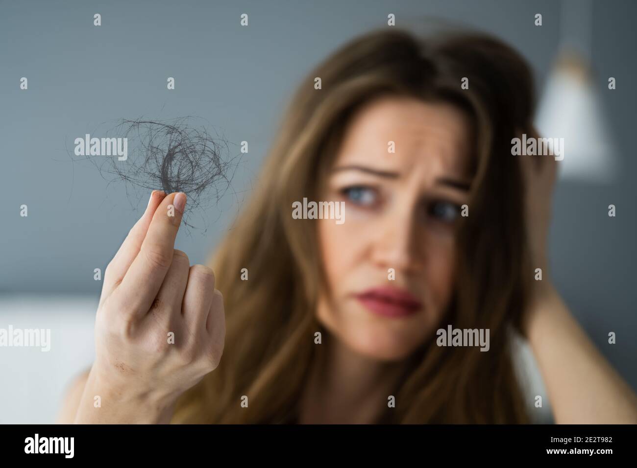 Close-up Of A Young Woman Holding Loss Hair Stock Photo