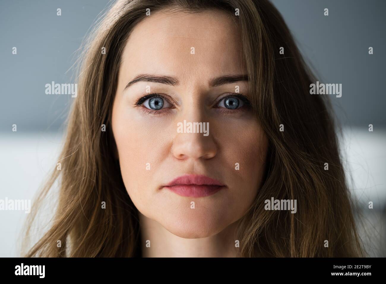 Woman After Anti Age Rejuvenation Lift Treatment Stock Photo