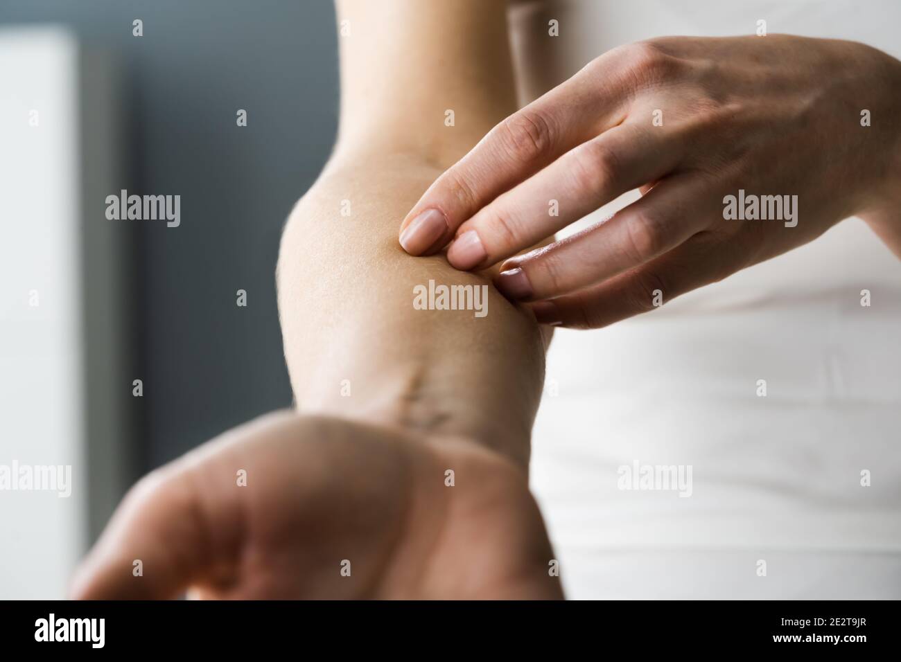 Woman Scratching Itching Body Skin With Allergy Stock Photo