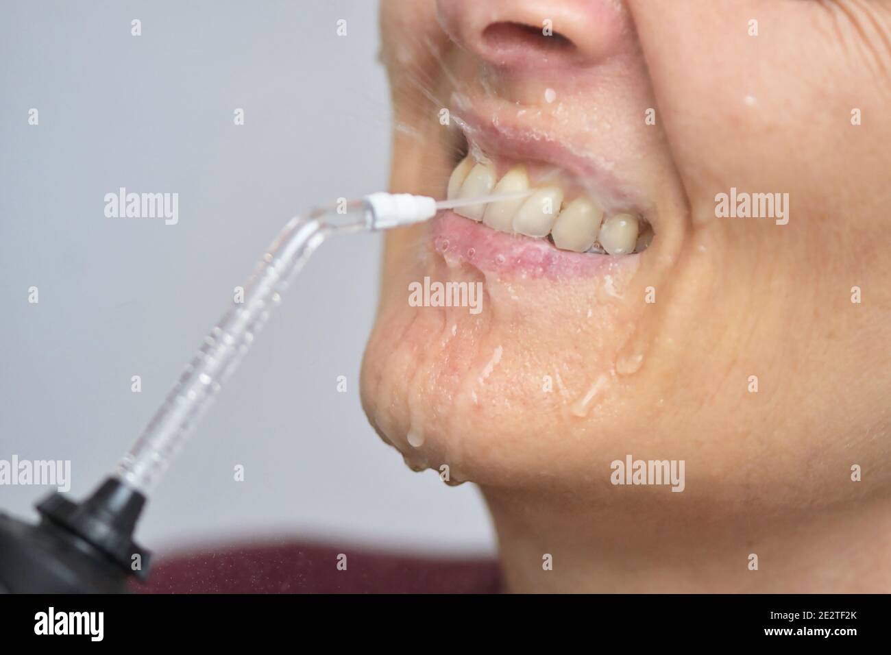 Portrait Of A Young Womanand and Professional Oral Irrigator or Flosser Stock Photo