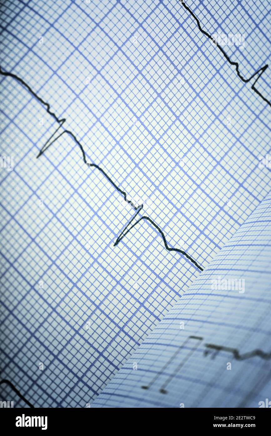 ECG complexes on lined paper Stock Photo - Alamy