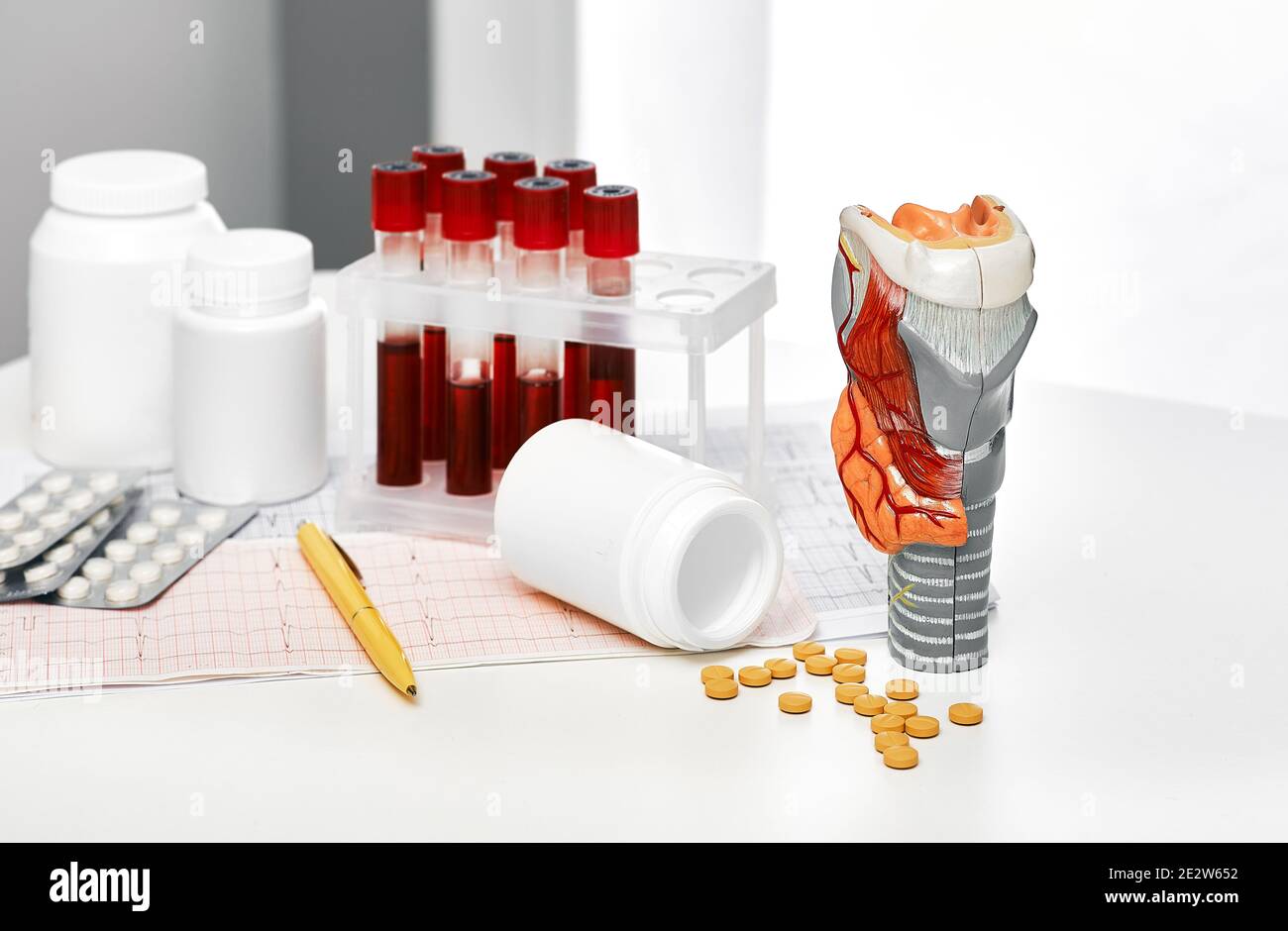 Anatomical model of the thyroid gland, blood for analysis in test tubes