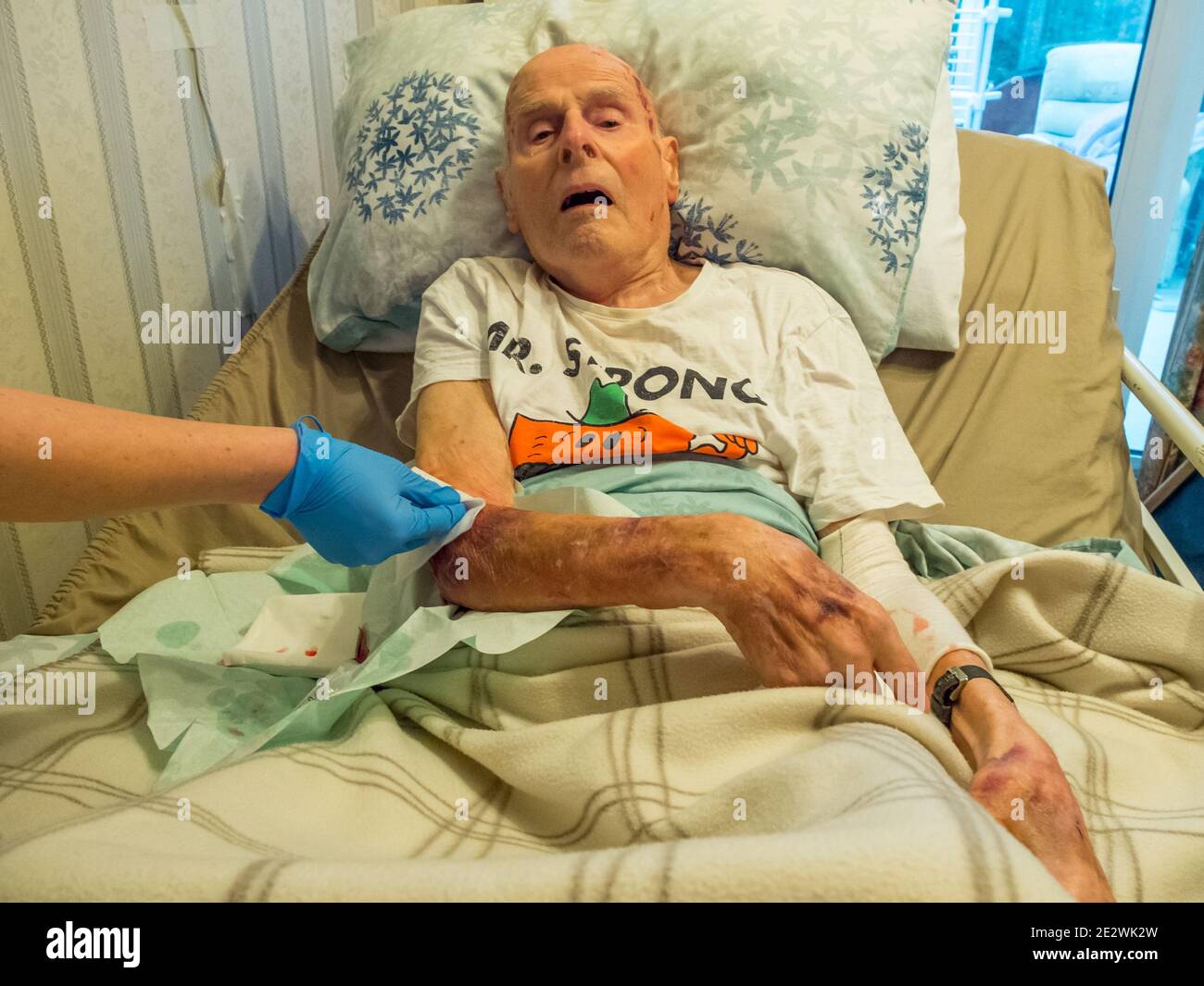 Patient Skin Is Ripped Using Covid-19 protection,a district nurse dresses the 95 year old man ...
