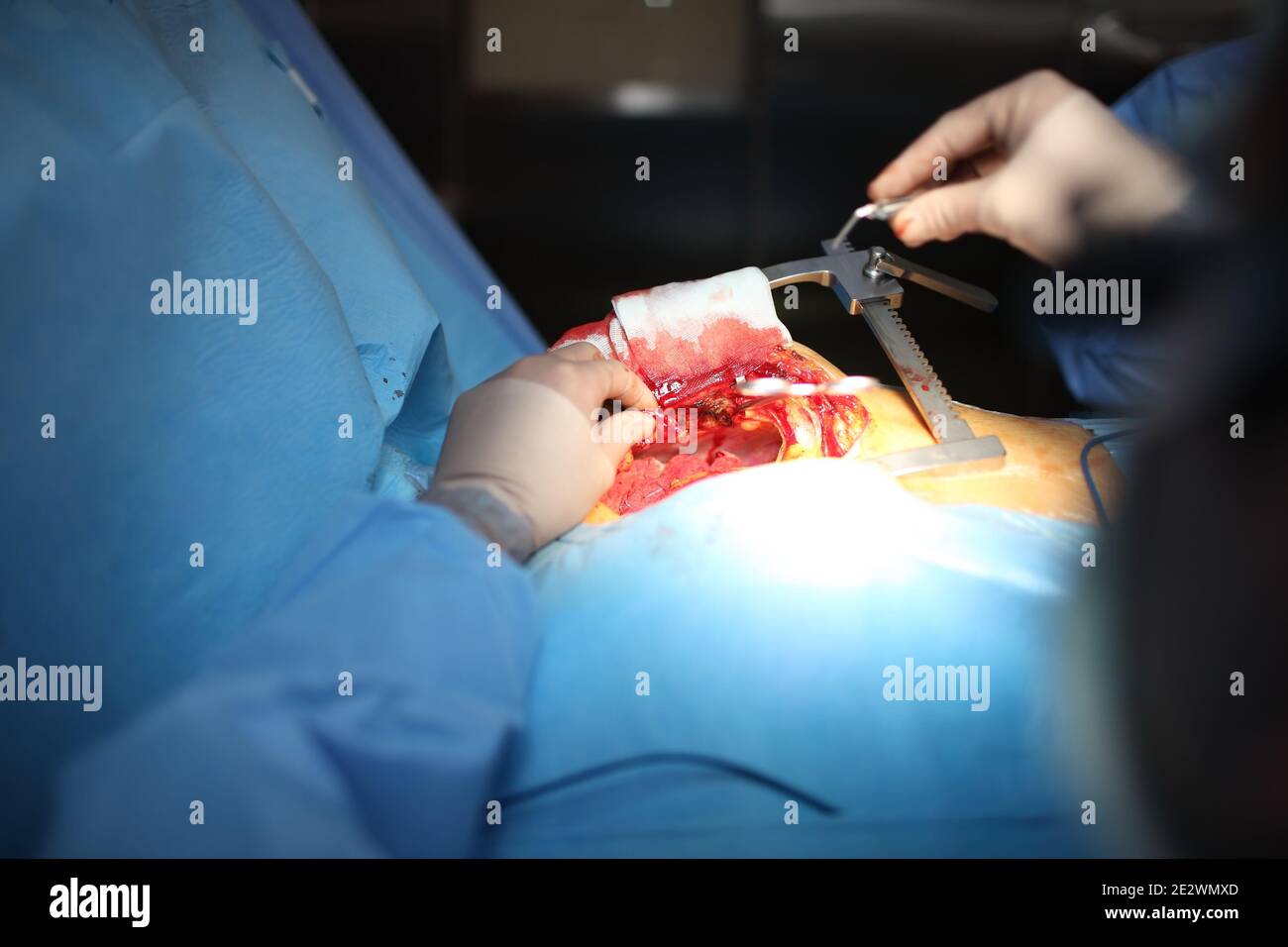 Starting surgical treatment, concept of surgeon job. Stock Photo