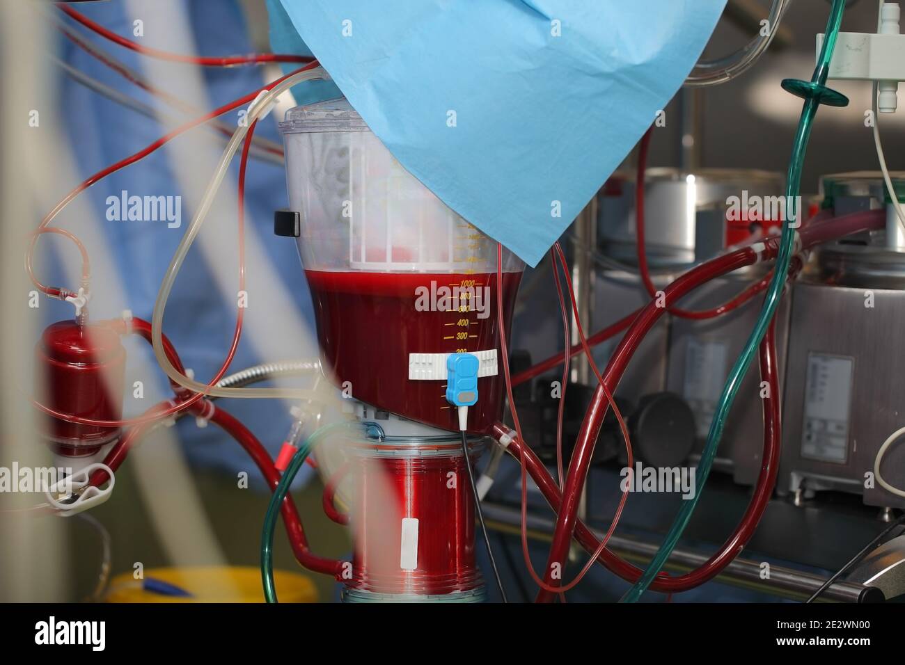 Artificial blood-circulation apparatus full of blood. Stock Photo