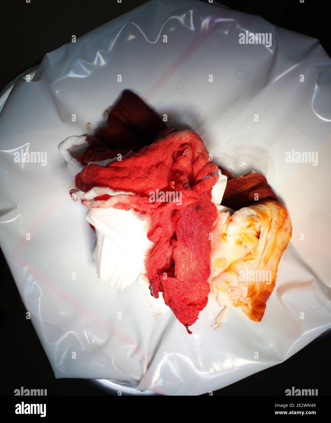 Blood on the gauze during surgical operation. Stock Photo