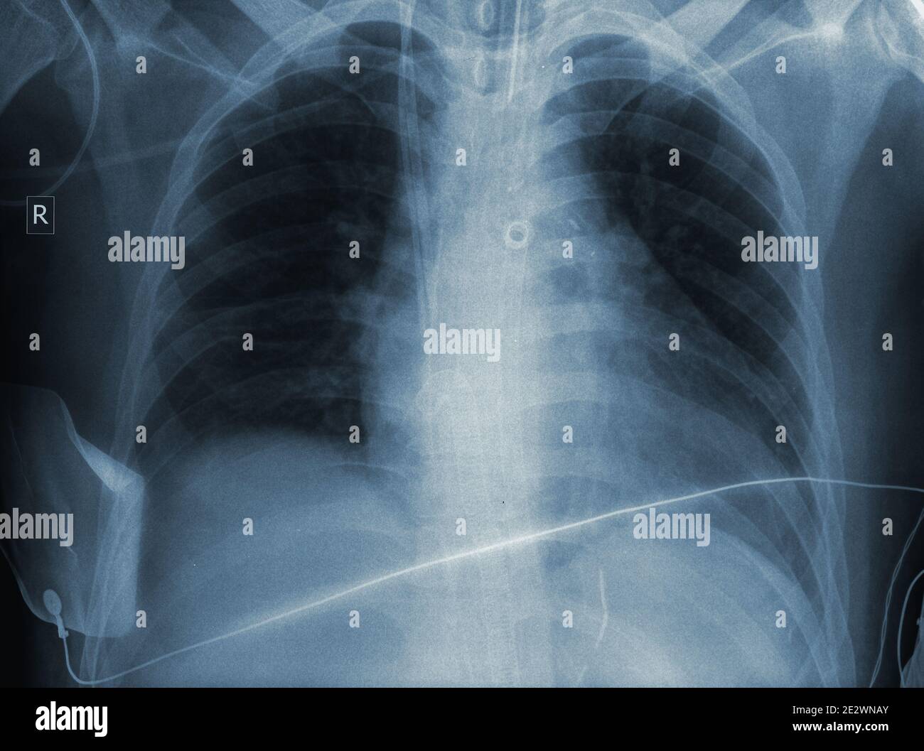 Result of an x-ray examination. Stock Photo