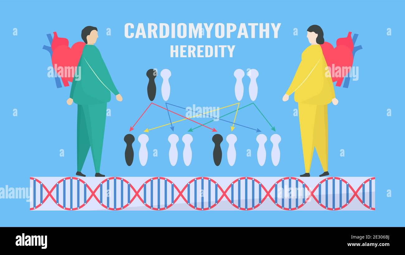 Cardiology vector illustration. This calls Cardiomyopathy. This disease, heart muscle is hard to pump blood to body. Main types include HCM, DCM, and Stock Vector