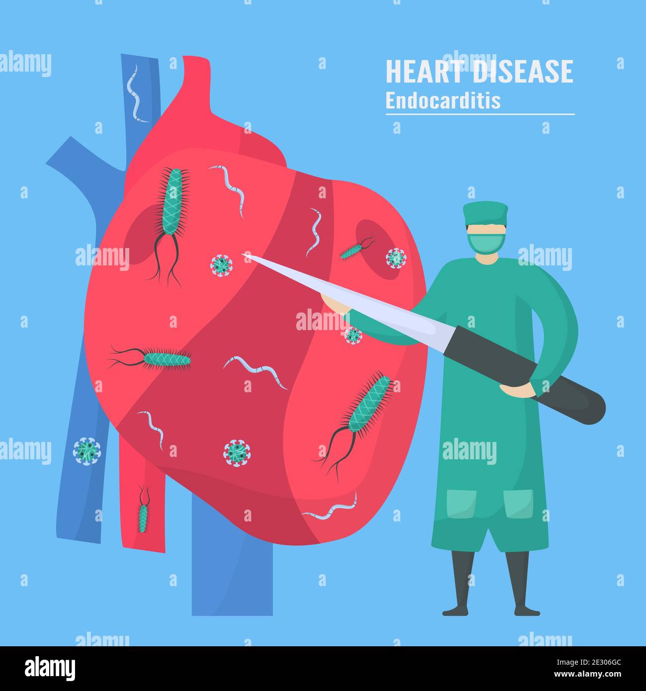 Cardiology treatment. This disease calls endocarditis. It is infection