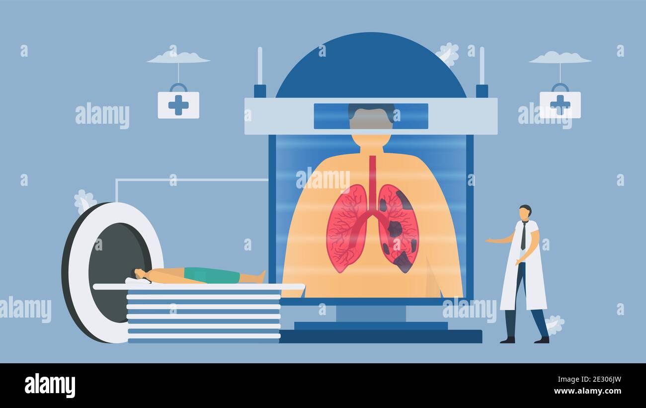 CT scanning systems for chronic obstructive pulmonary disease testing. Pulmonology vector illustration. Stock Vector