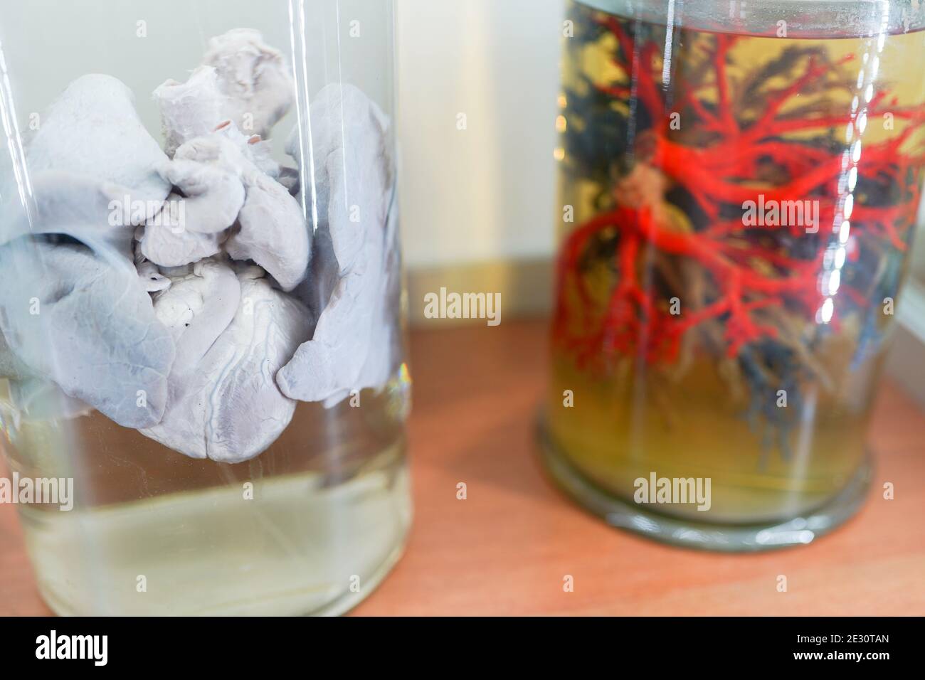 human organs in formalin Stock Photo Alamy
