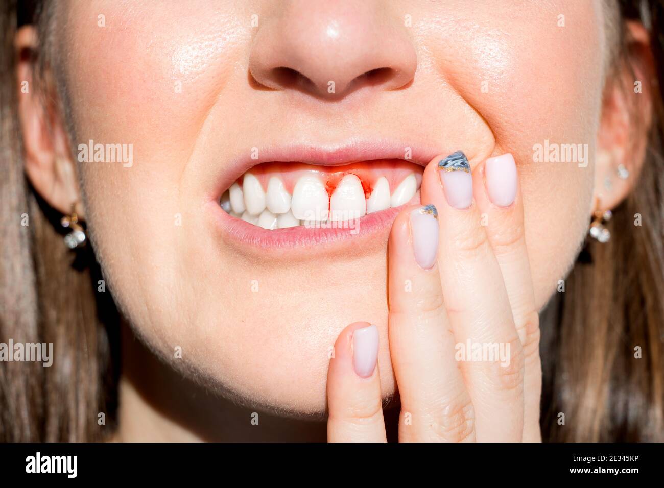 Woman filling pain because of bleeding gums. Periodontal disease