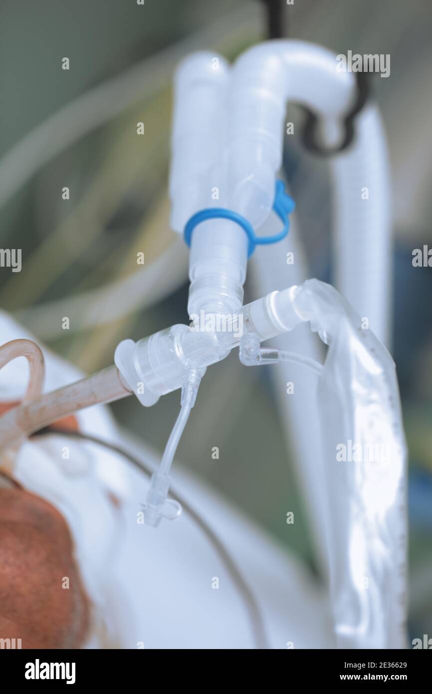 Lung ventilation equipment of the patient Stock Photo Alamy