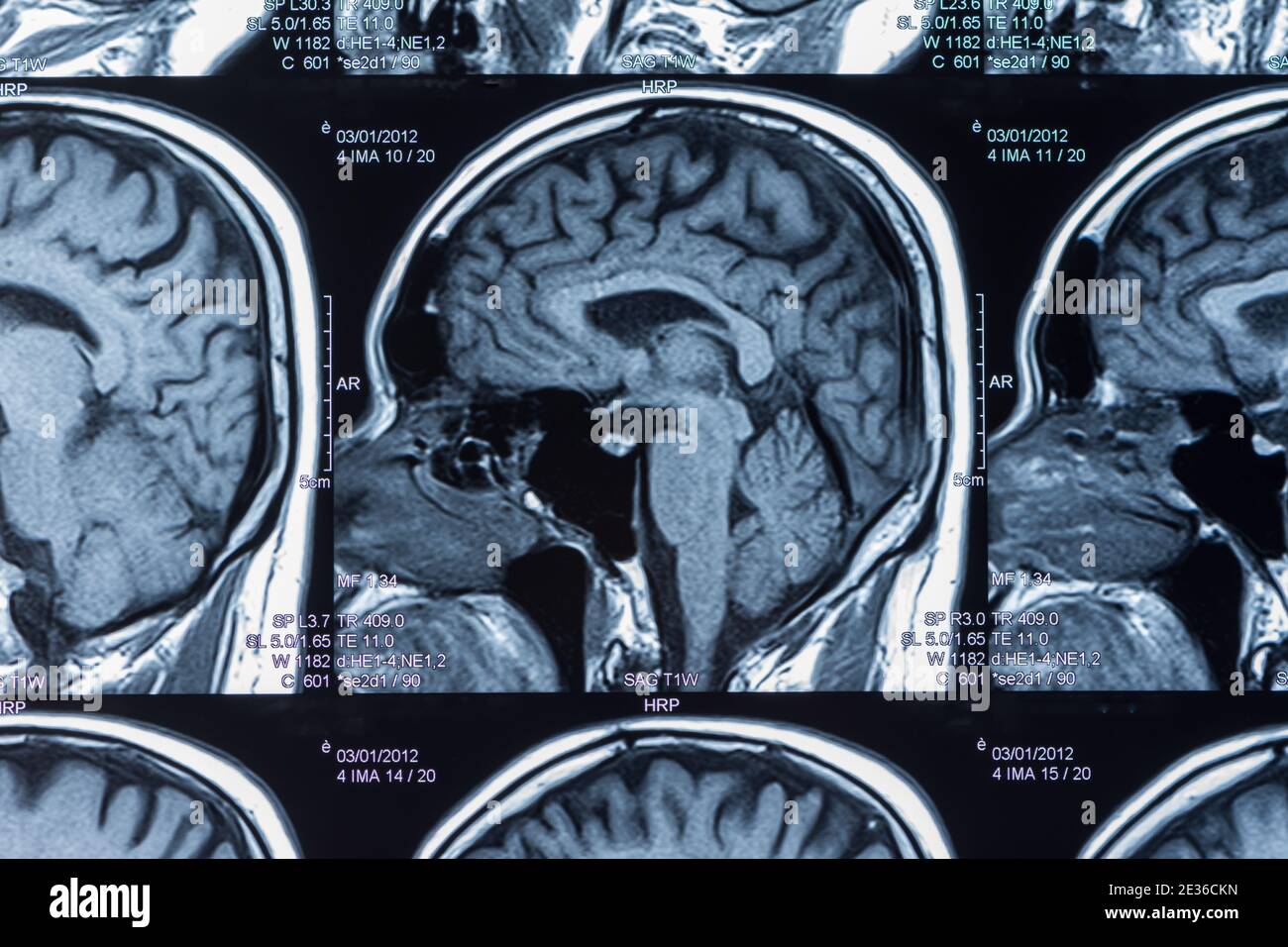 mri scan of brain by computer tomography. Stock Photo