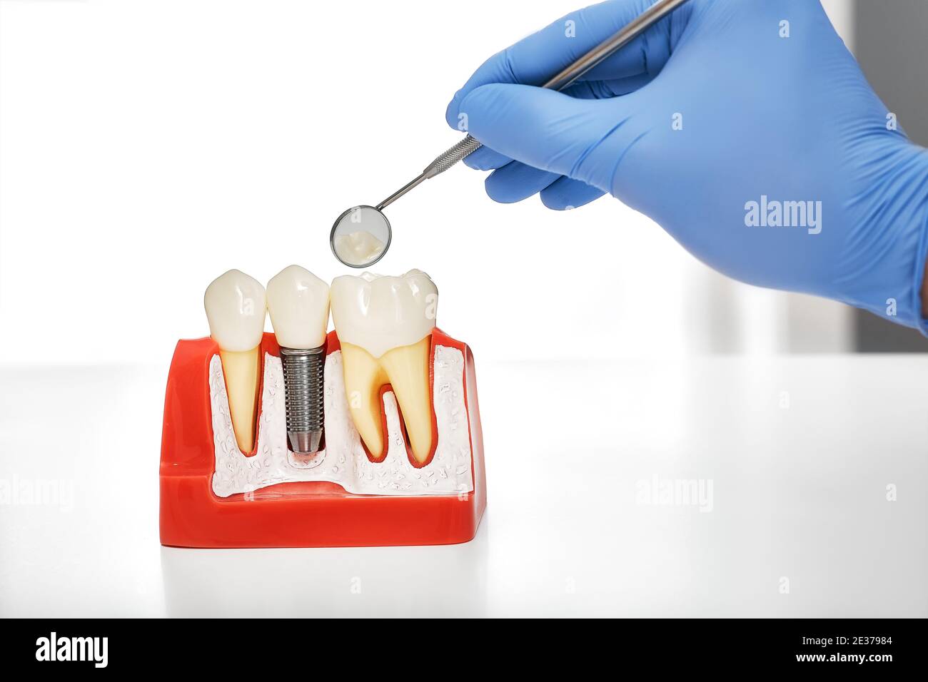 Teeth checkup and dental prosthetics. Mouth mirror in hand