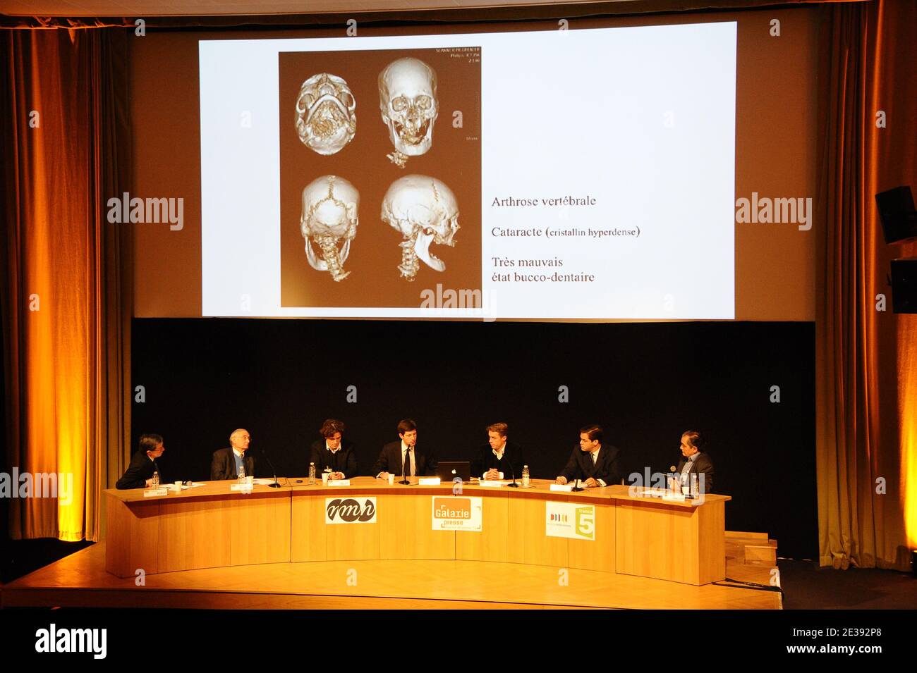 French doctor Philippe Charlier among other scientists said they have identified an embalmed head as belonging to King Henri IV of France, who was assassinated in 1610 at the age of 57 during a press conference held at Grand Palais in Paris, France on December 16, 2010. The head was lost after revolutionaries ransacked the royal chapel at Saint Denis, near Paris, in 1793. A head, presumed to be that of Henri IV, has passed between private collectors since then. Photo by Nicolas Briquet/ABACAPRESS.COM Stock Photo