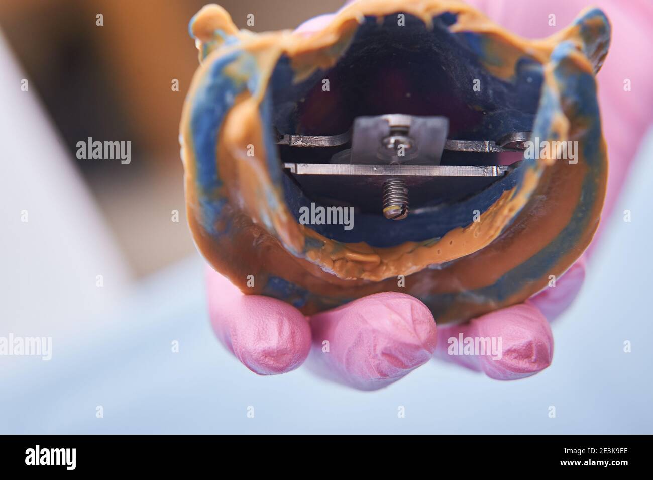 Dental surgery. Dental technician making dentures. Dental prosthesis in