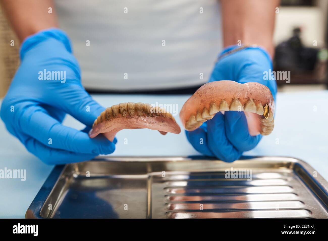 Dental surgery. Old dental prosthesis in medical hands before
