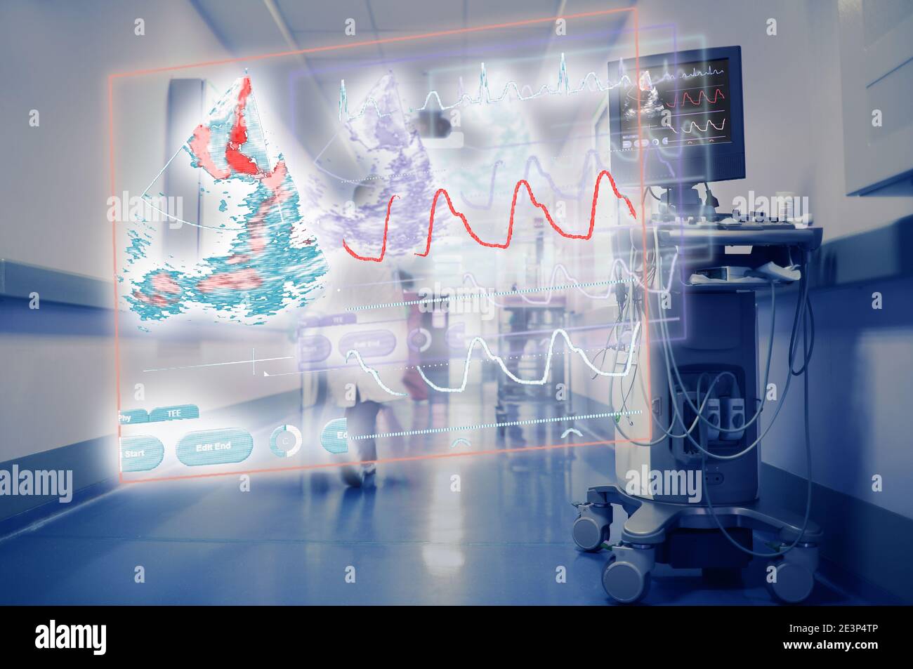 Projection of the heart monitor in hospital hallway on the background of walking workers. Stock Photo