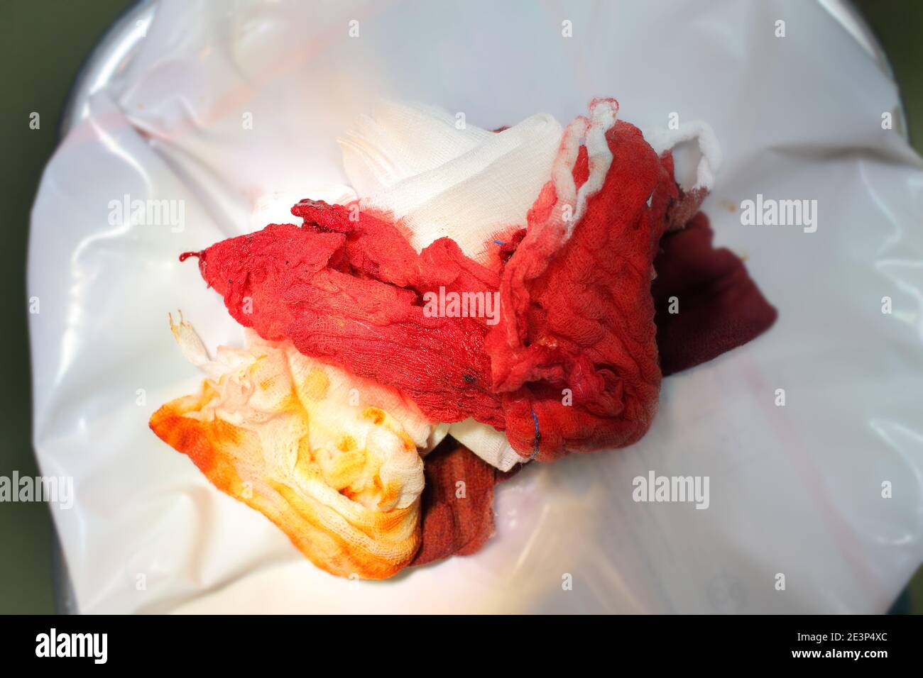 Blood-stained bandage in the hospital garbage disposal bin. Stock Photo